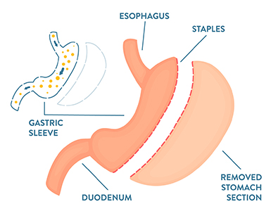 A diagram of a stomachDescription automatically generated