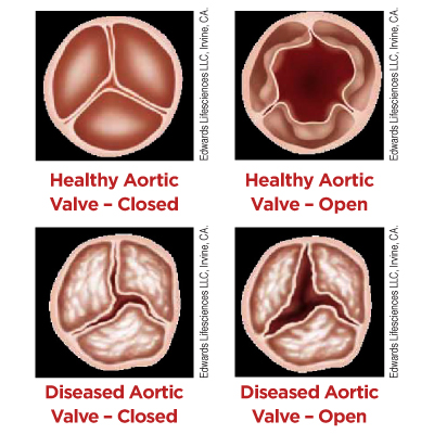 Heart Anatomy  The Texas Heart Institute