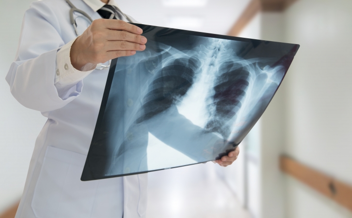 Learn about COPD and treatment options COPD Disease Facts and Treatments