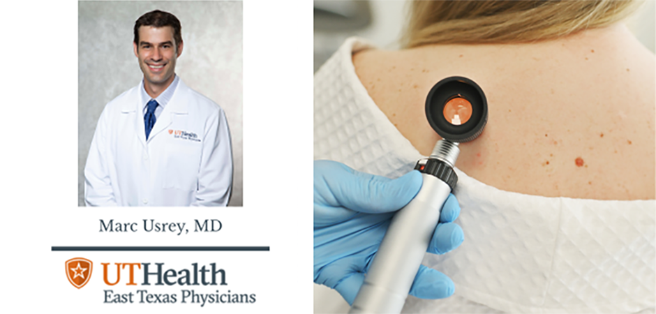 What you need to know about skin cancer What you need to know about skin cancer