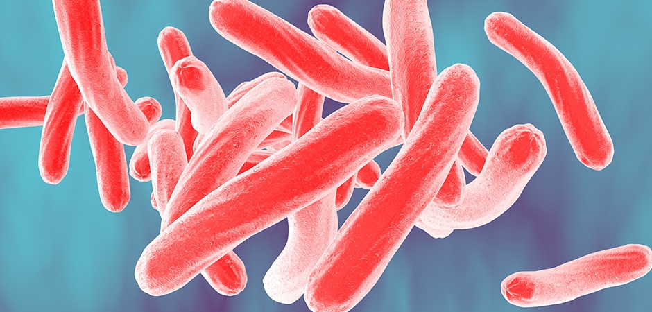Tuberculosis Tuberculosis
